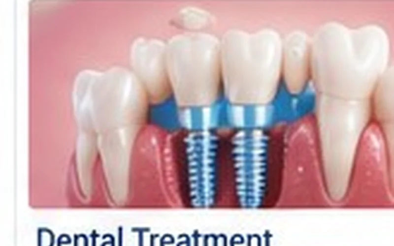 Dental Treatment Implants and restorative dentistry