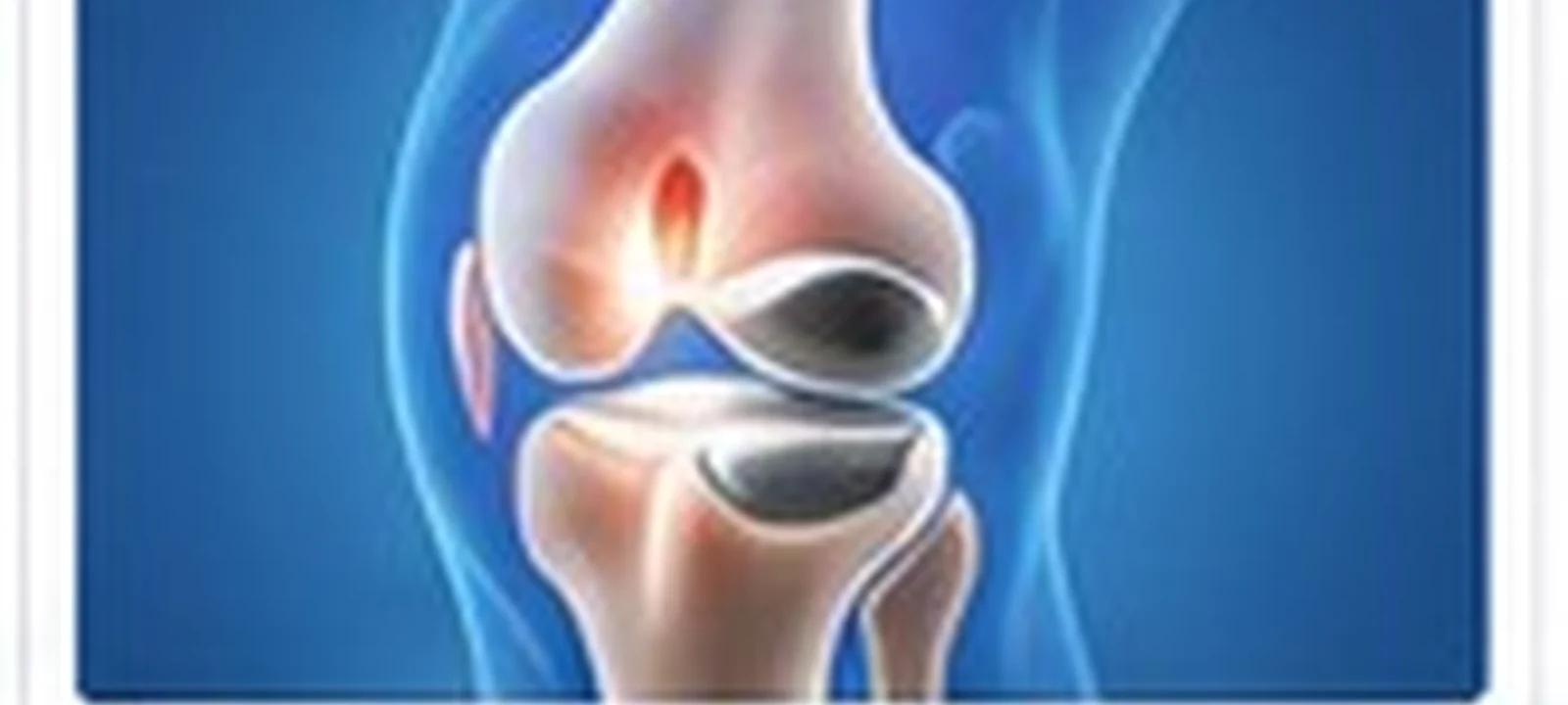 Total knee replacement (single) | Hospitals of India